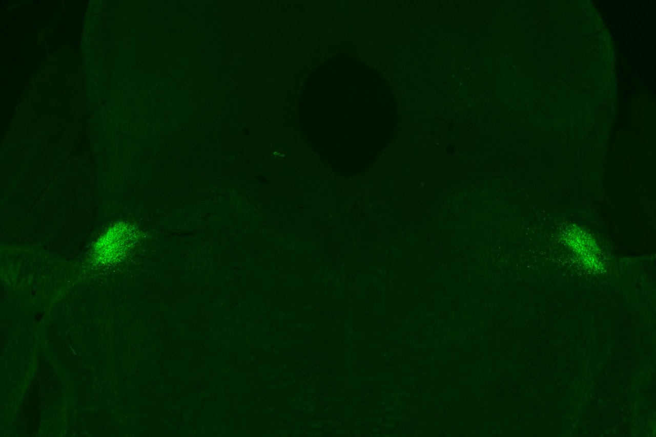 CGRP