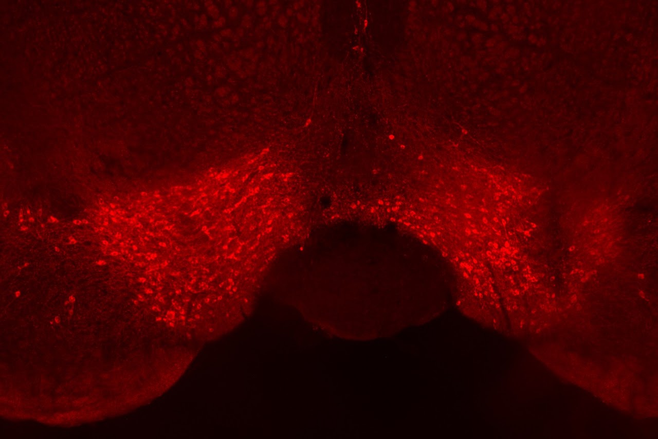 Dopamine